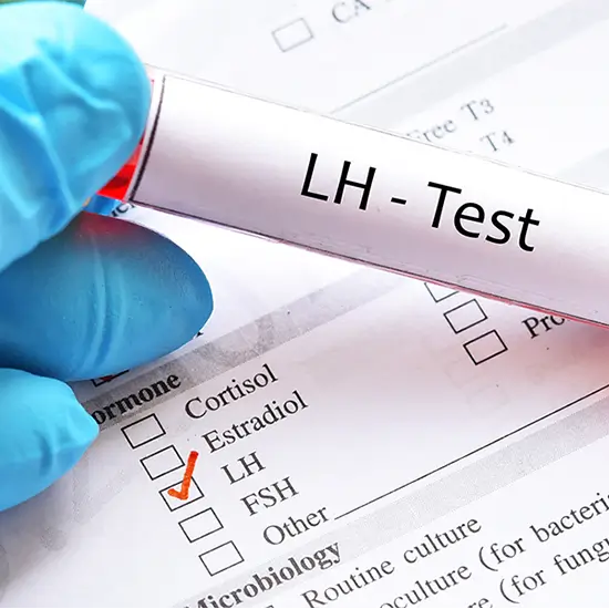 lh and testosterone total test